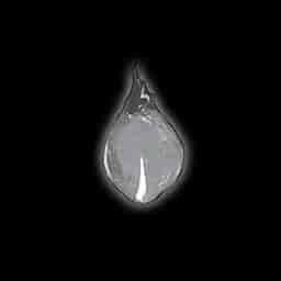 Impure Phlogiston